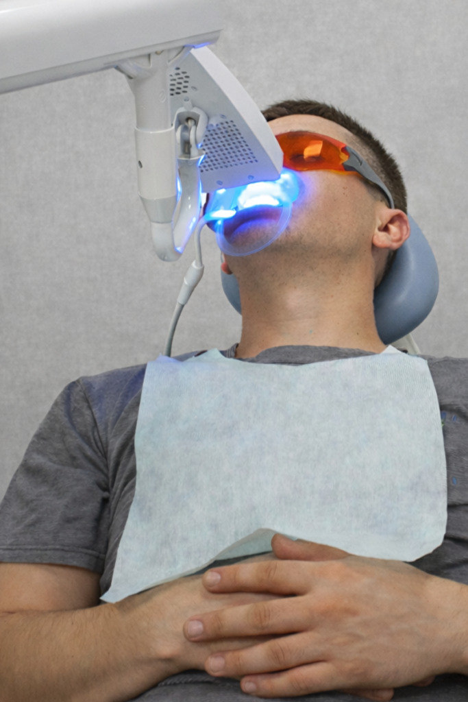 Blanqueamiento Dental