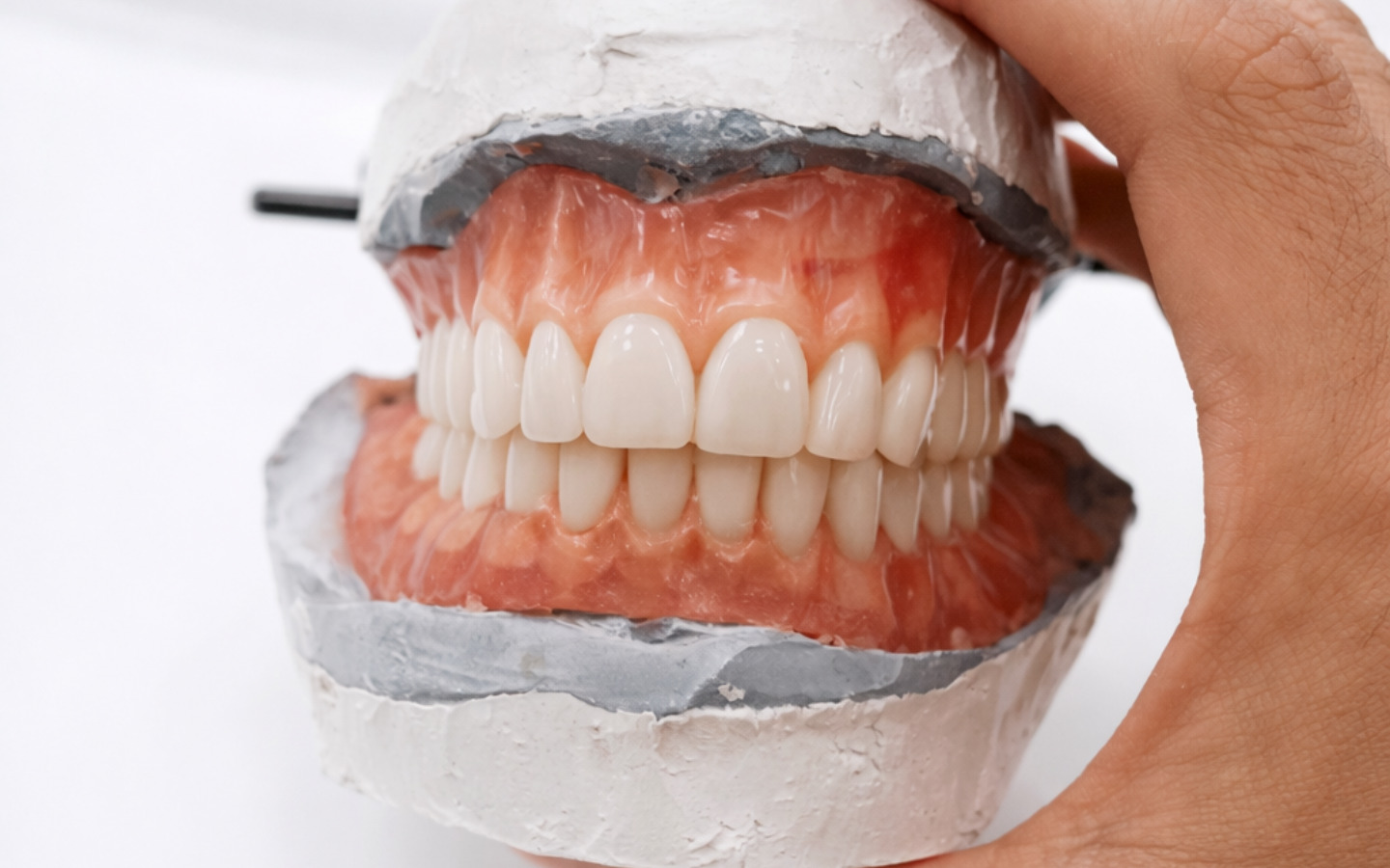 Rehabilitación Oral