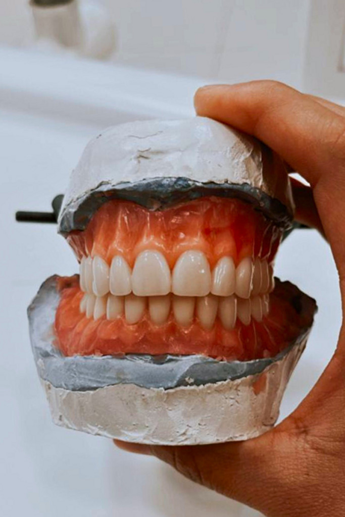 Rehabilitación Oral